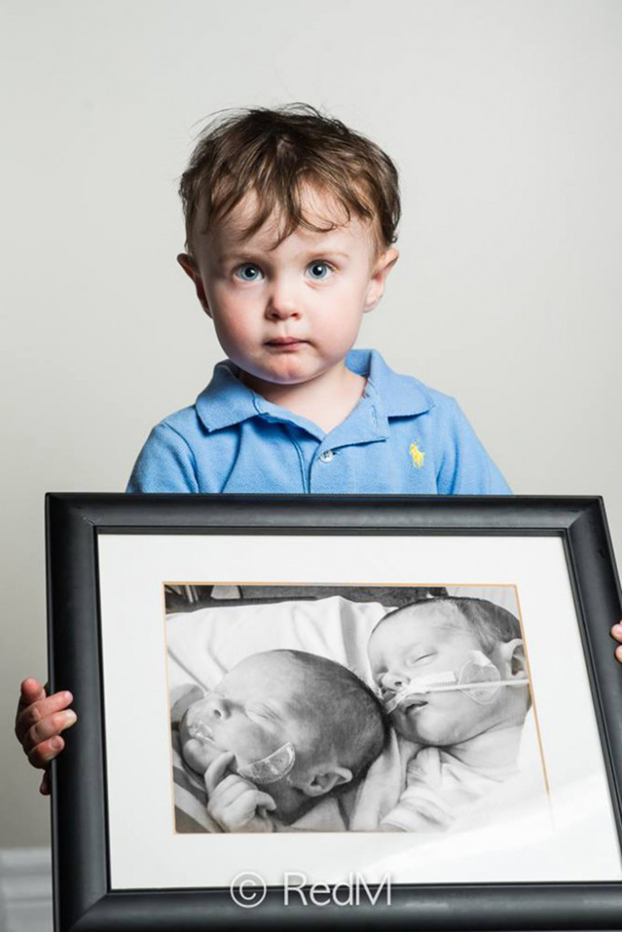 premature-baby-portraits-les-premas-red-methot-17-683x1024
